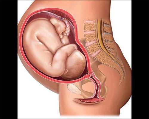 子宫开始病变时，身体会有4种迹象，若一个不占