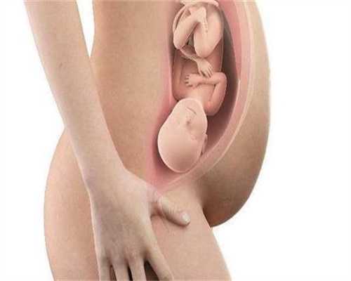 代怀孕初期吐酸水怎么办